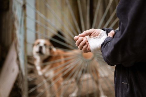 A person wrapping an injured hand while a dog stands behind a gate, illustrating a dog bite case handled by a Houston dog bite lawyer.
